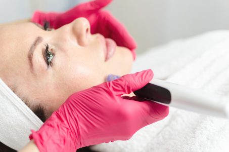  Mesoterapia senza aghi con dermapen