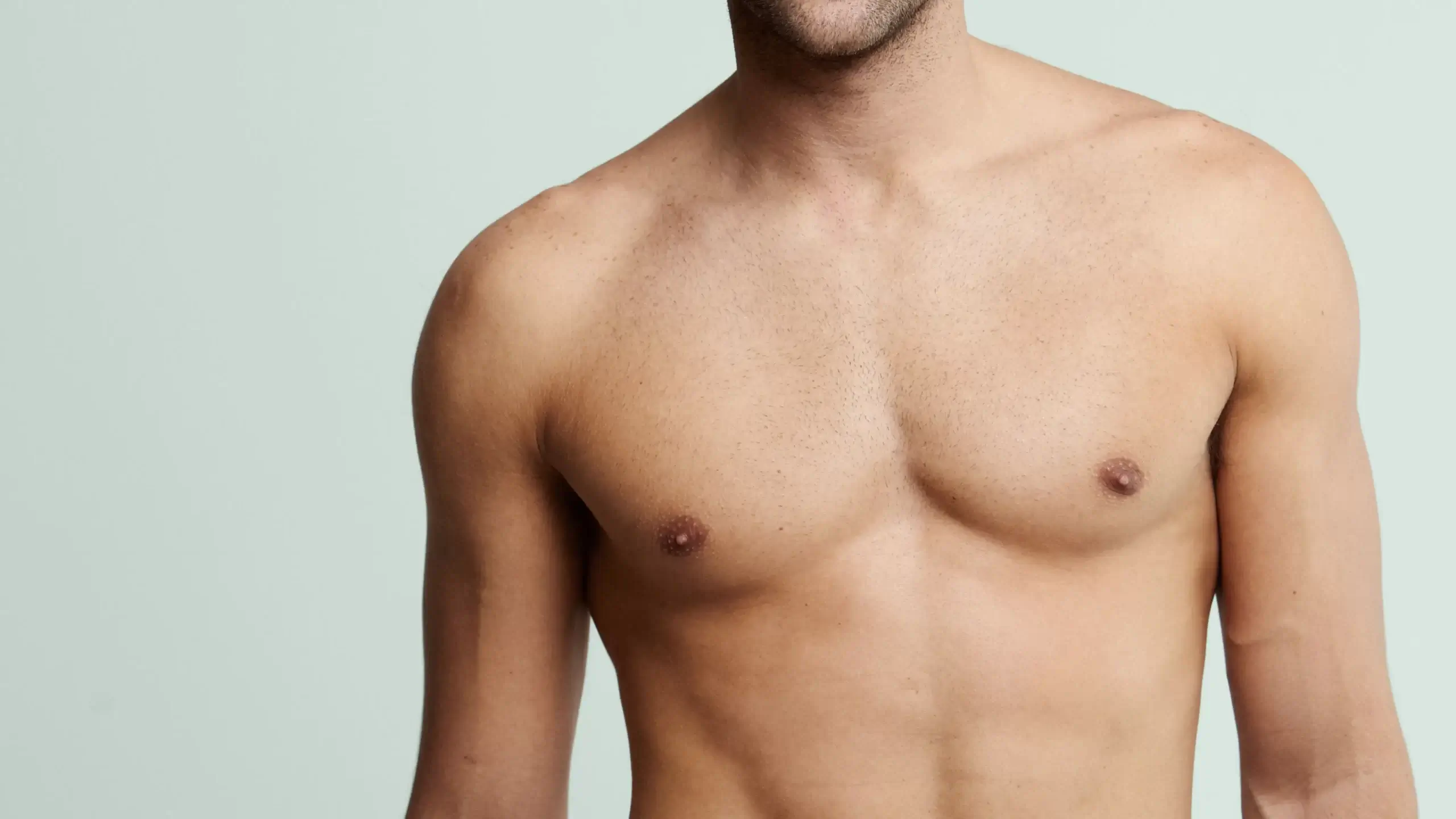 Parte superiore del corpo di un uomo, mostrando i risultati del trattamento per la ginecomastia, con un contorno toracico pi&ugrave; definito e piatto dopo la riduzione del volume del seno maschile.