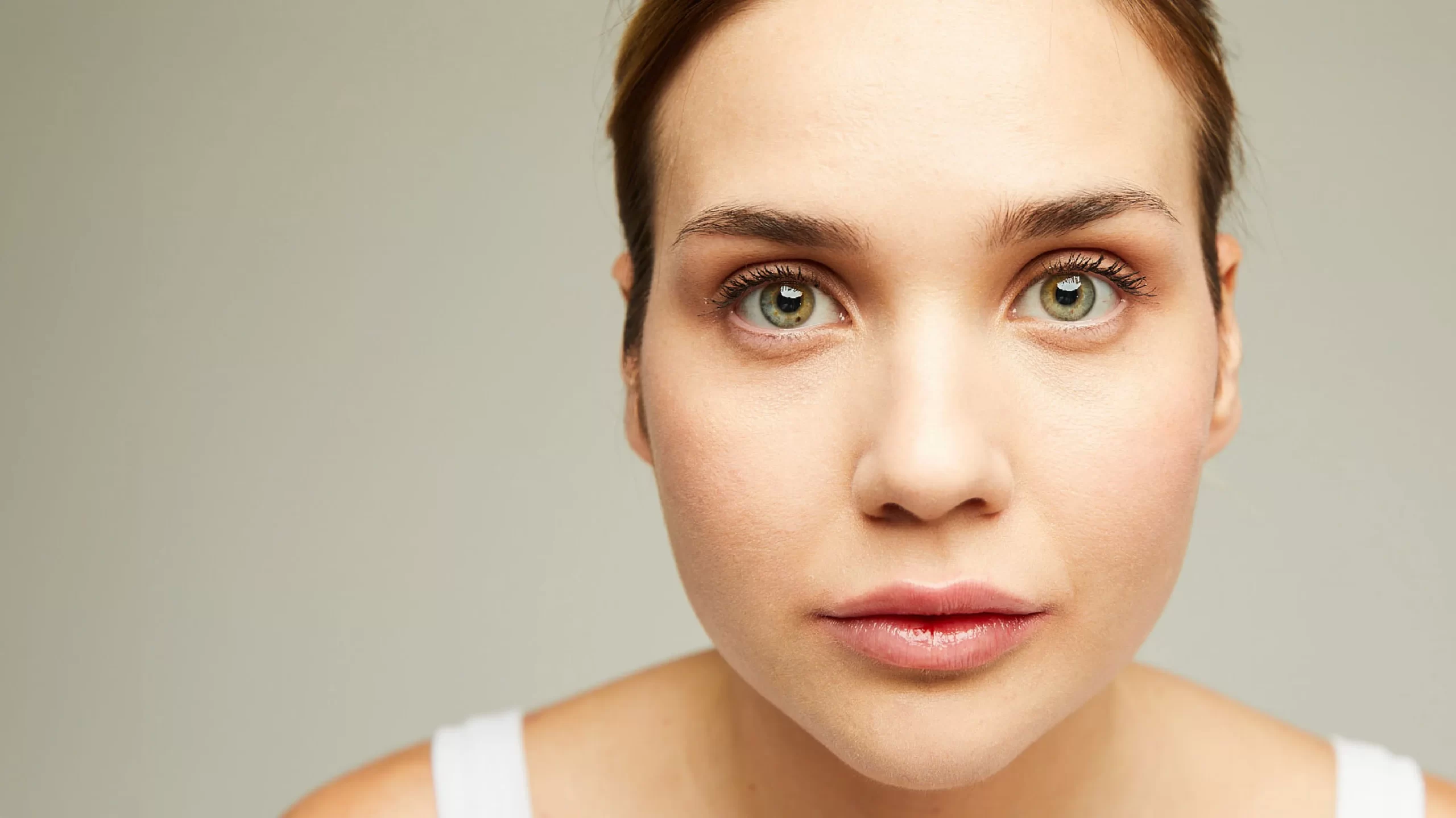Primo piano del viso di una giovane modella bionda con occhi verdi, evidenziando i risultati del lipofilling, con contorni del viso pi&ugrave; levigati e armoniosi grazie all'intervento di chirurgia estetica svolto presso IEI - Istituto Estetico Italiano