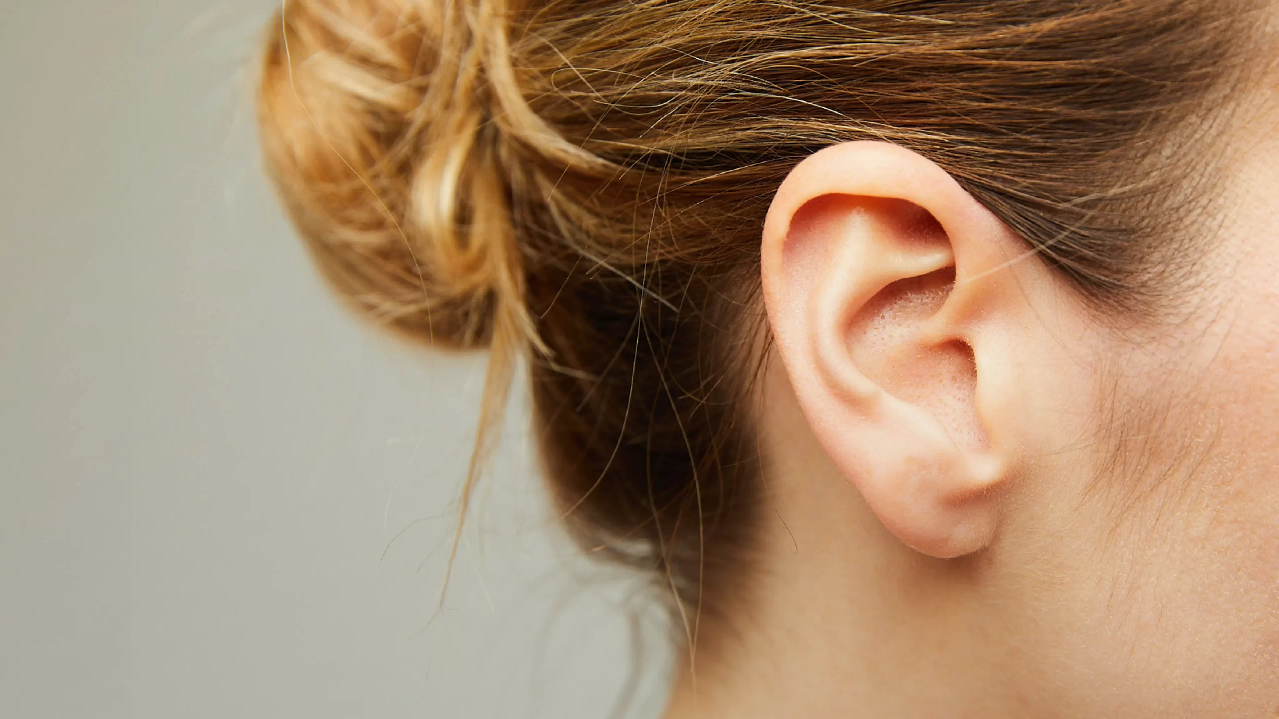 Immagine di un orecchio di modella, mostrato in primo piano per evidenziare i risultati estetici dell'otoplastica, con orecchie pi&ugrave; armoniose e ben aderenti al capo